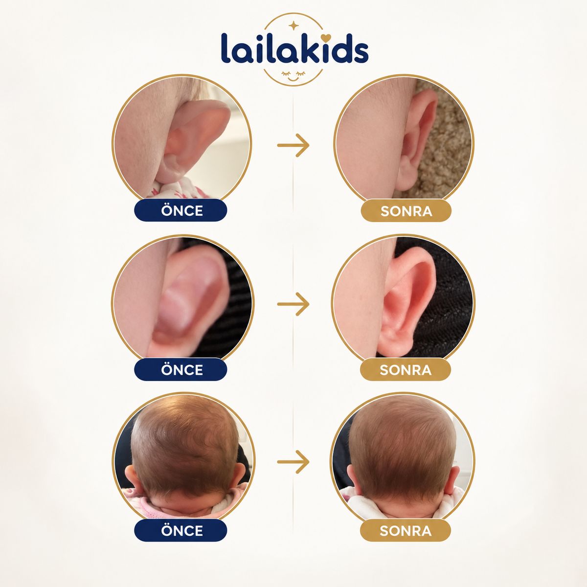 Laila Plus™ Bebek Kepçe Kulak Bandı