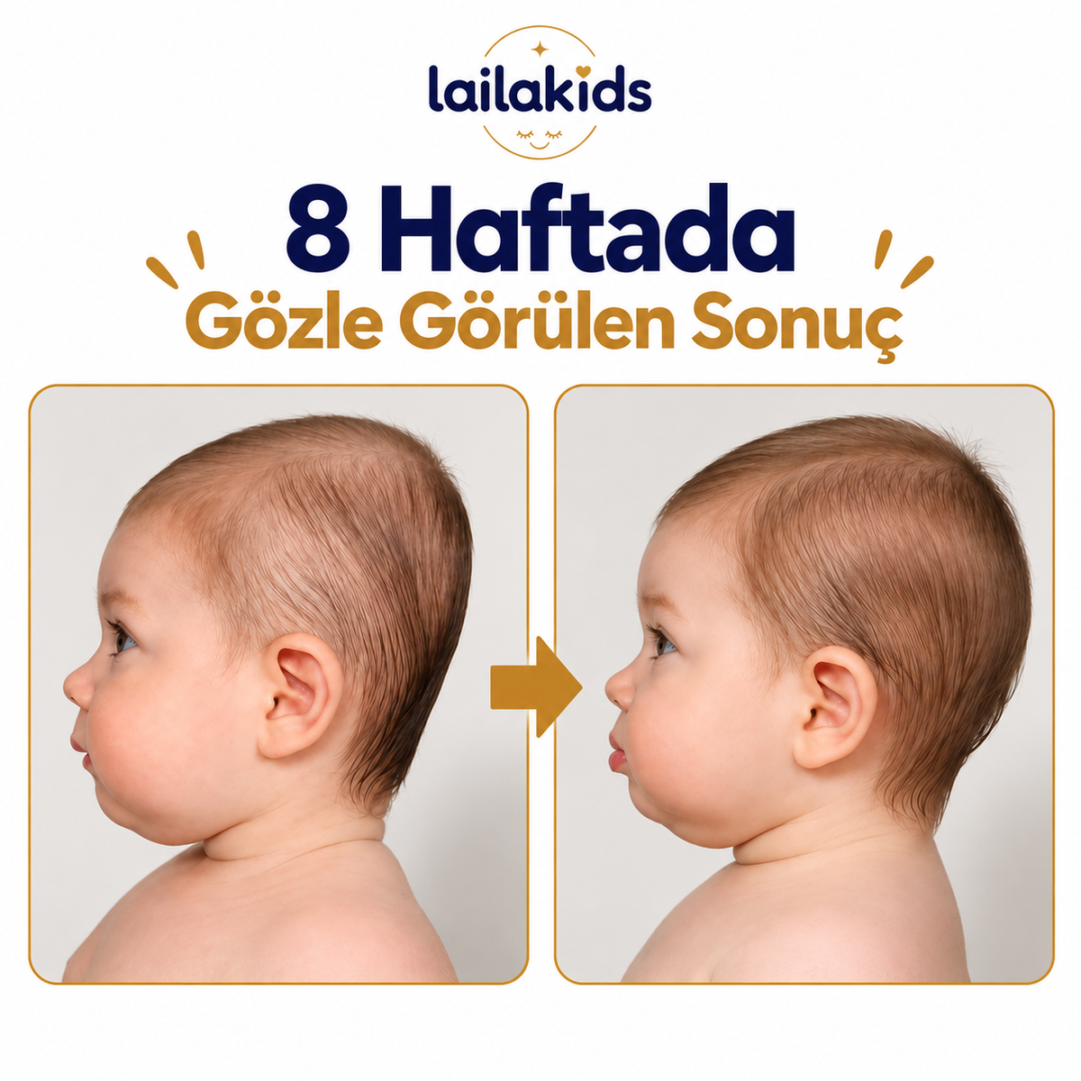 Laila Plus™ Düz Kafa Yastığı %100 Pamuk